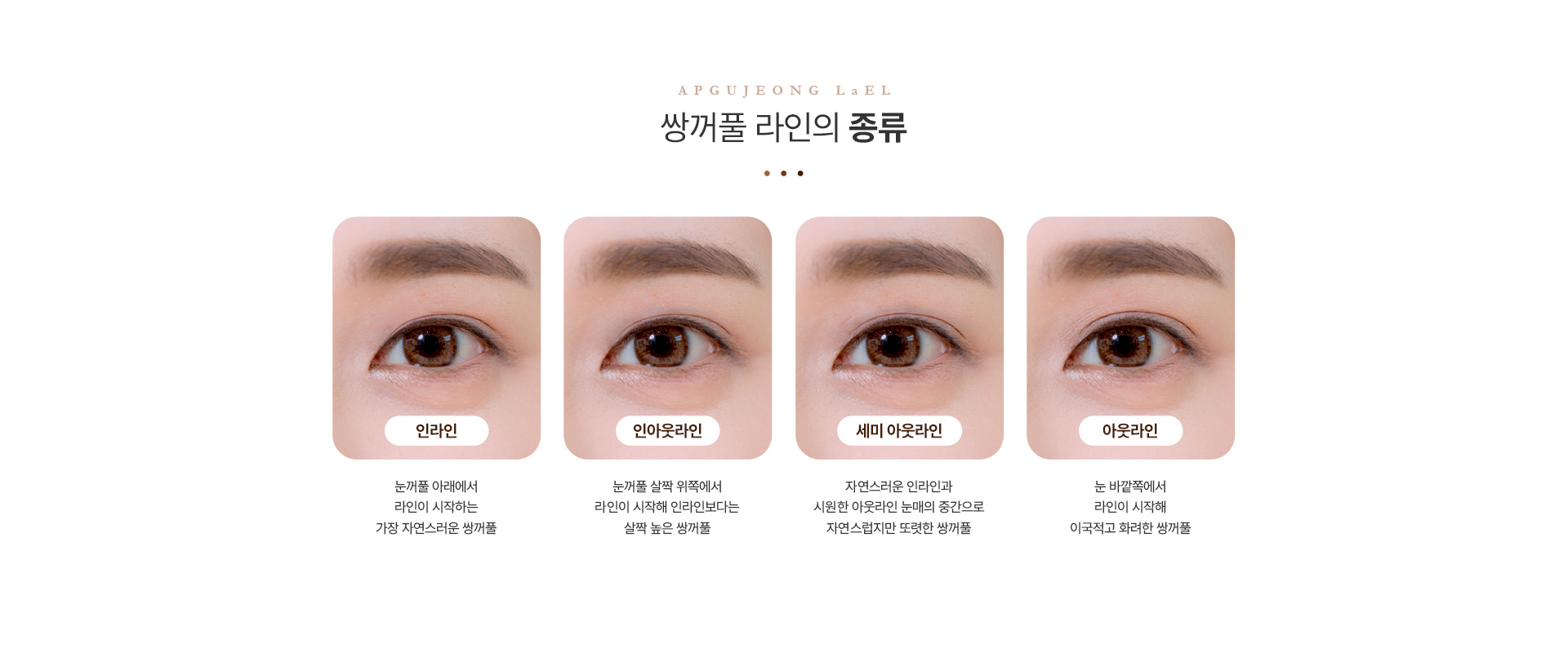 쌍꺼풀 종류