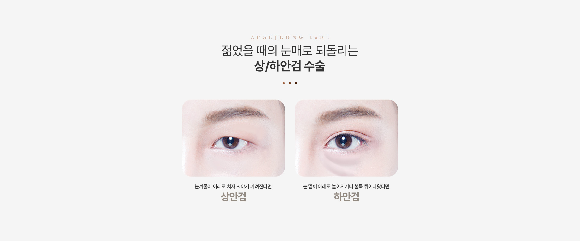 상/하안검 정의