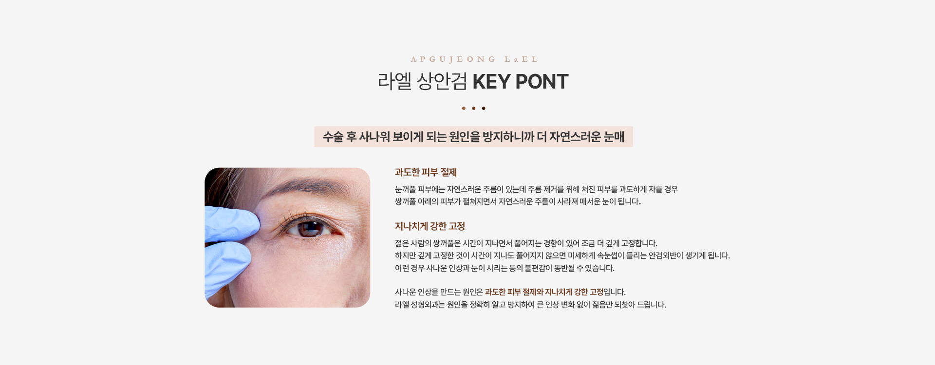 상/하안검 상안검키포인트