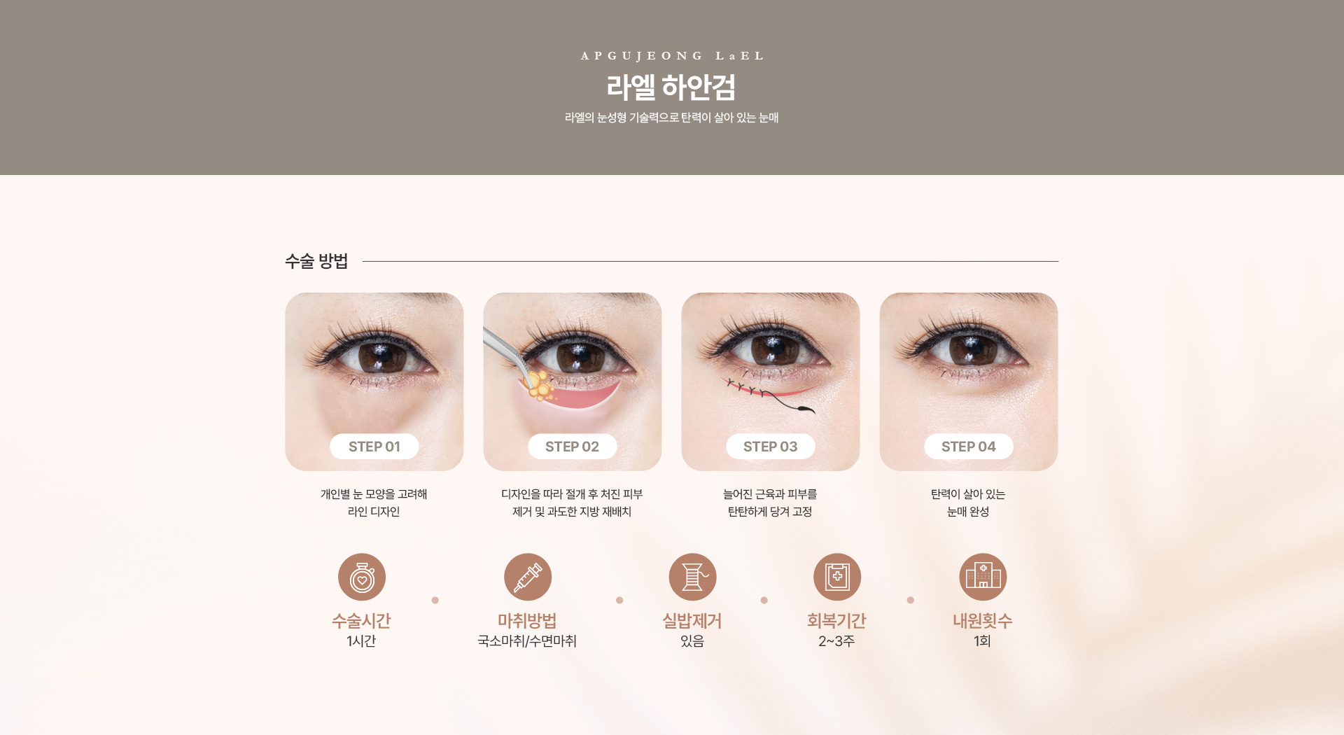 상/하안검 하안검