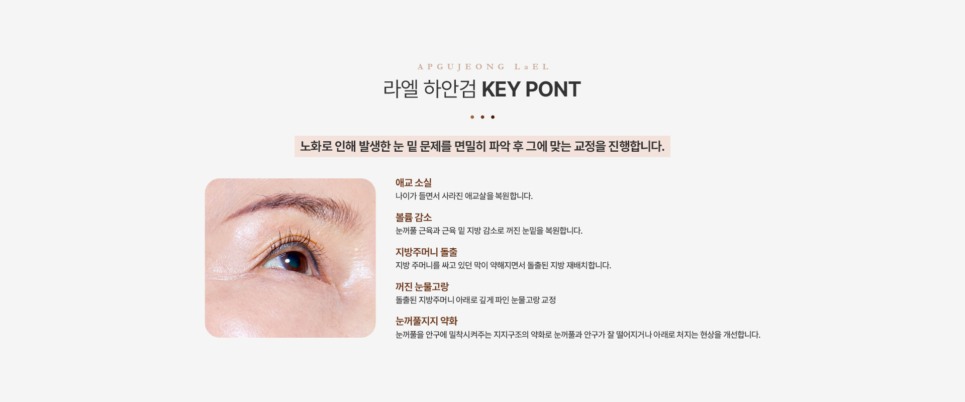 상/하안검 하안검키포인트