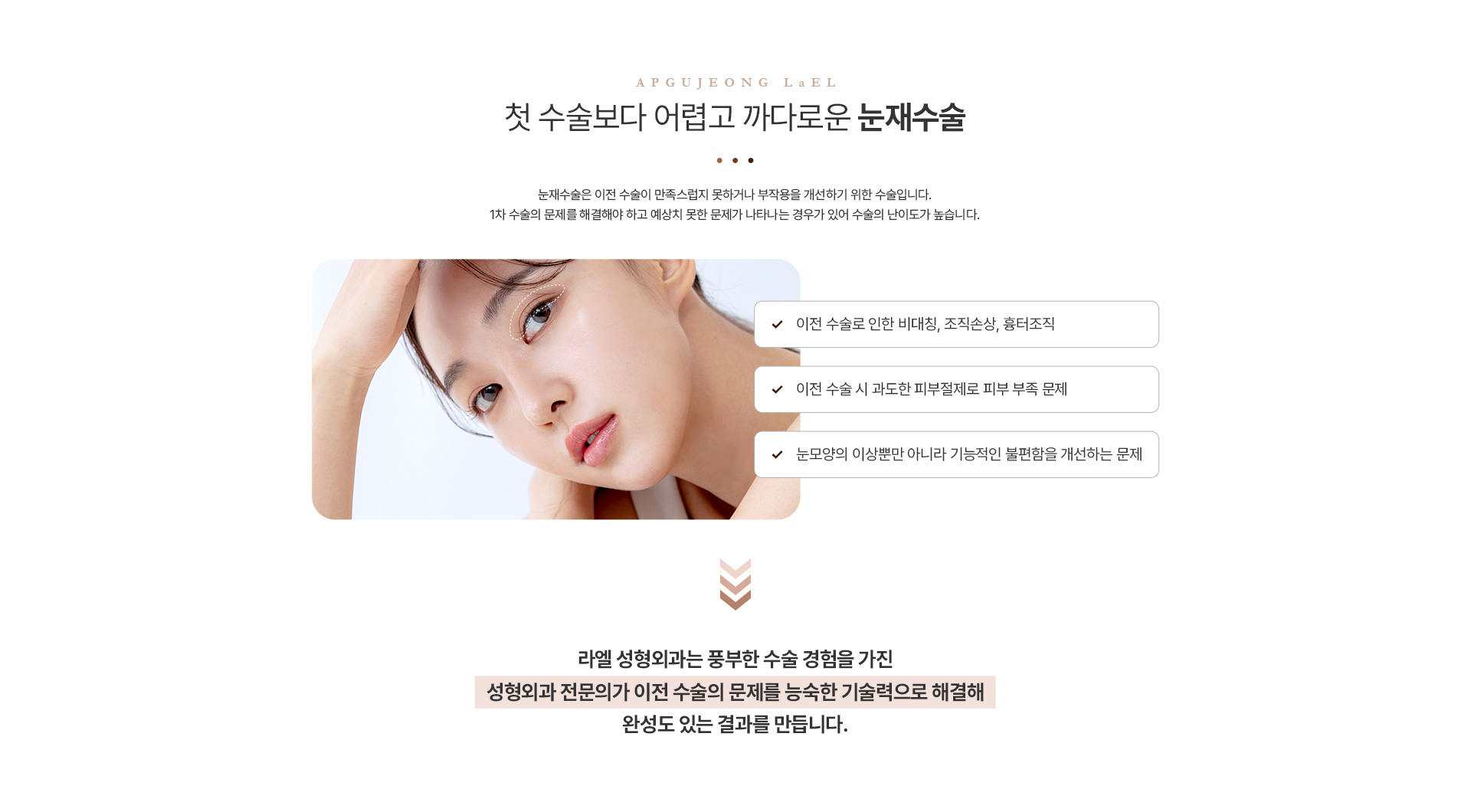 눈재수술 기술력