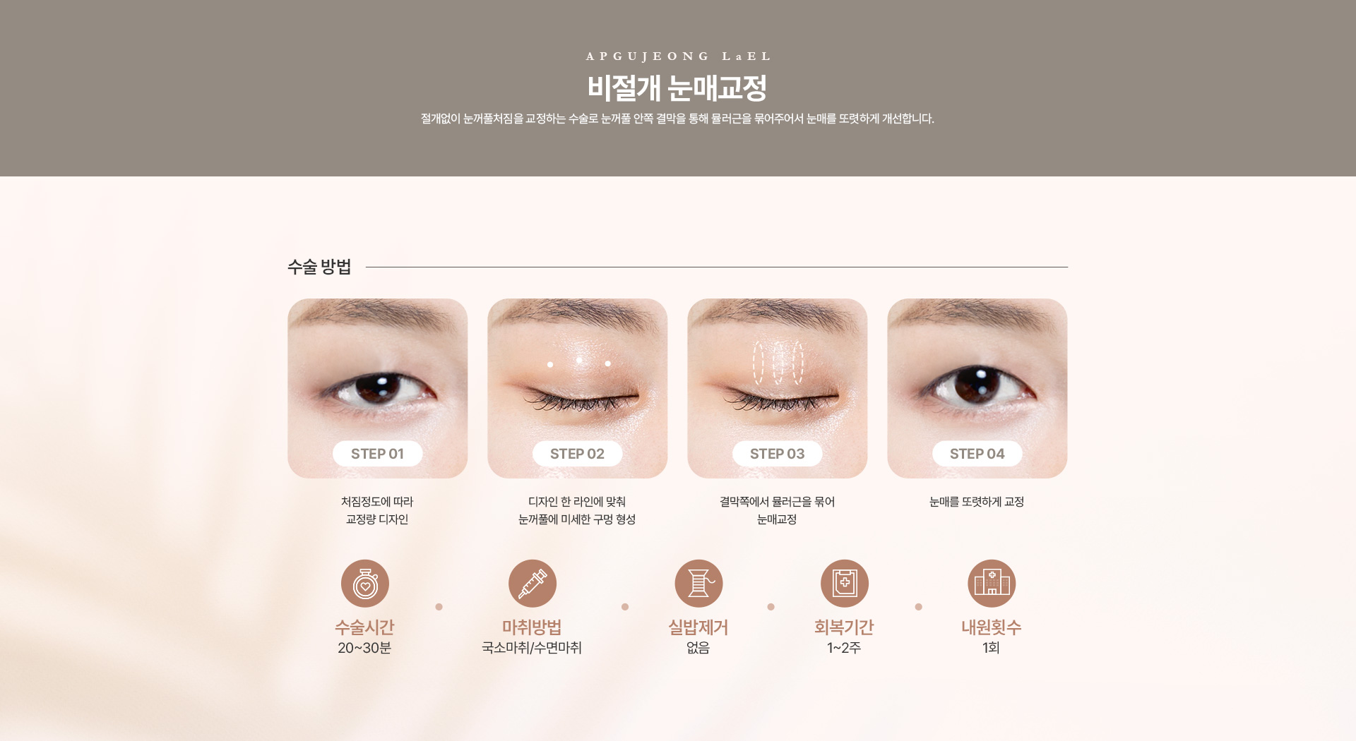 눈매교정 비절개눈매교정