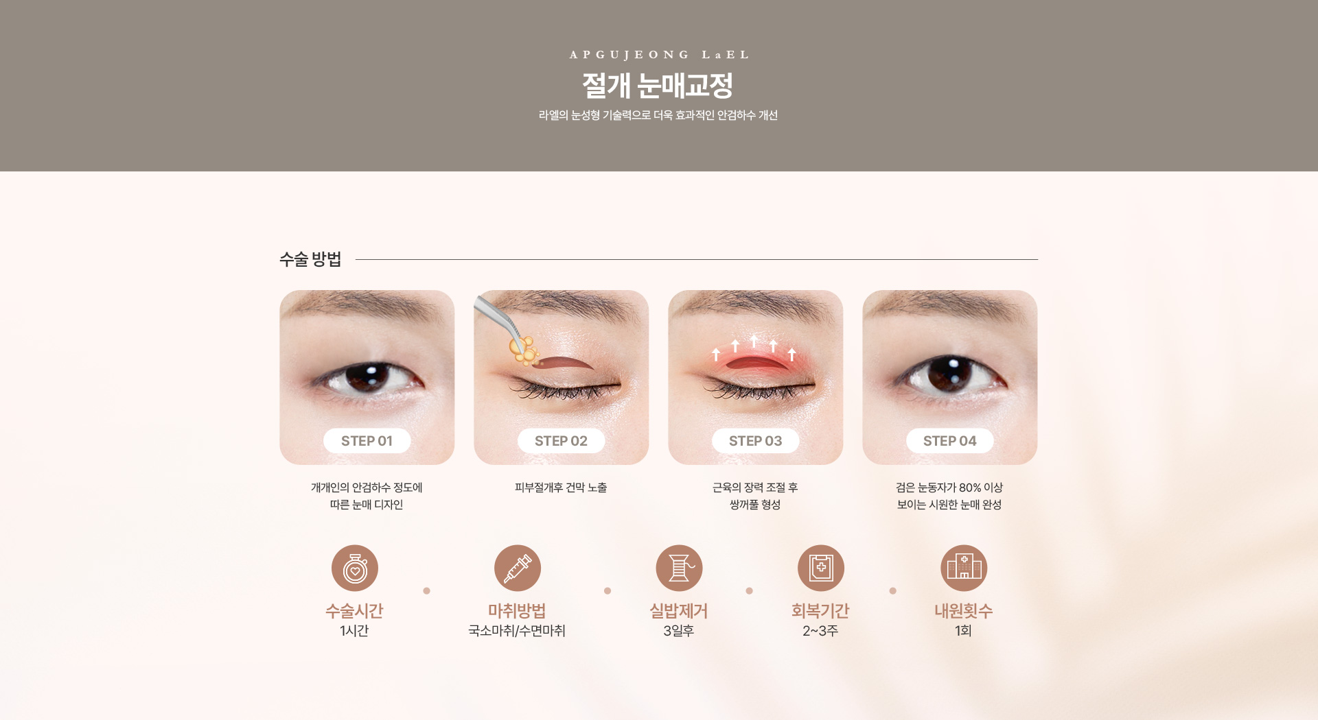 눈매교정 절개눈매교정