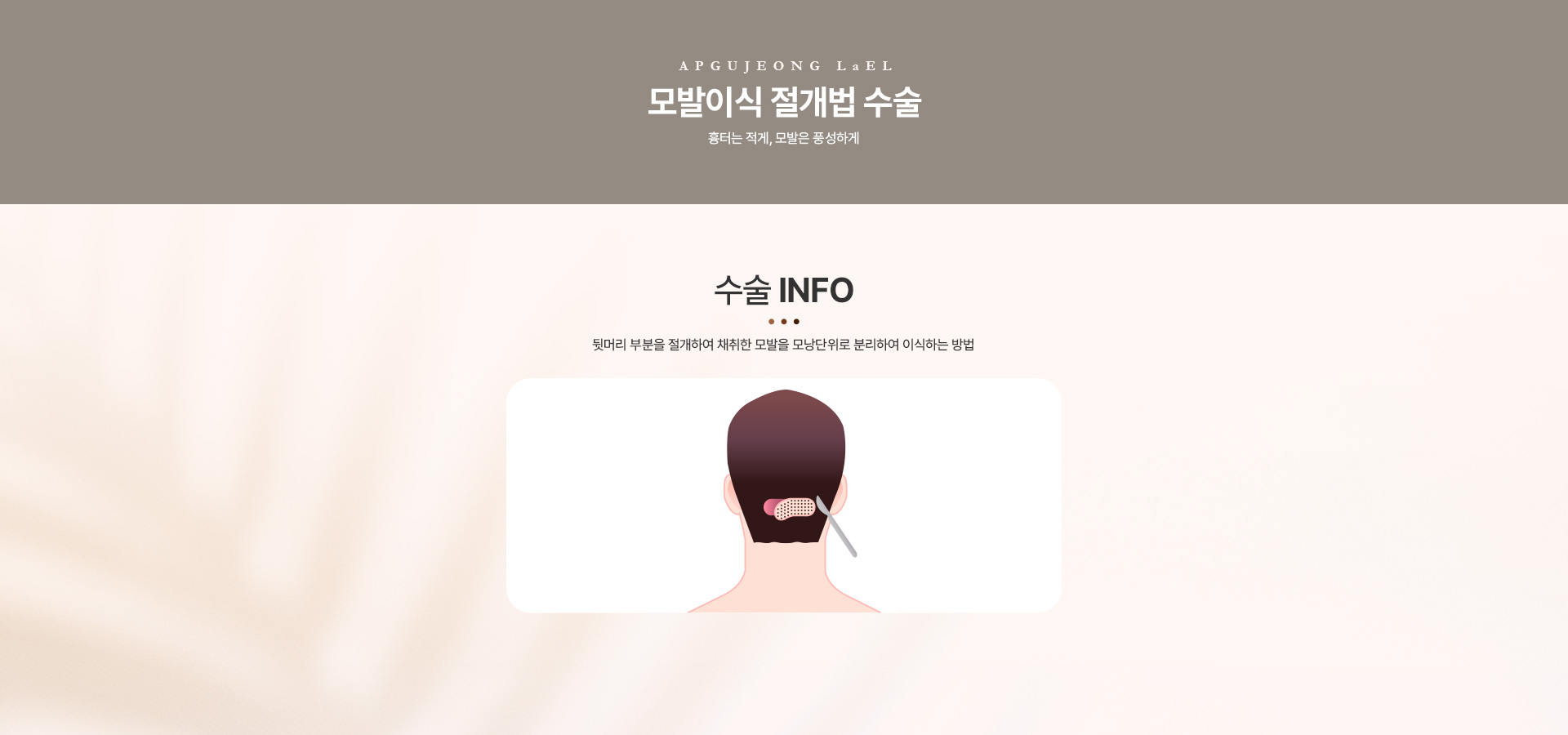 모발이식 절개법