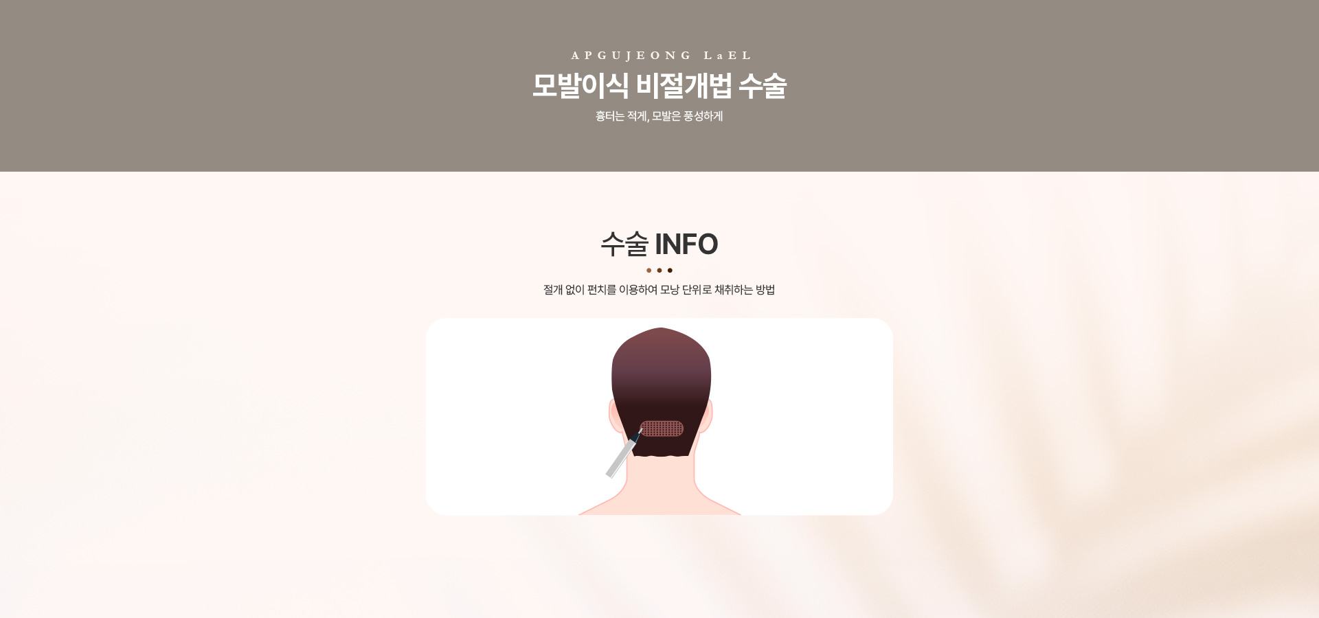 모발이식 비절개법