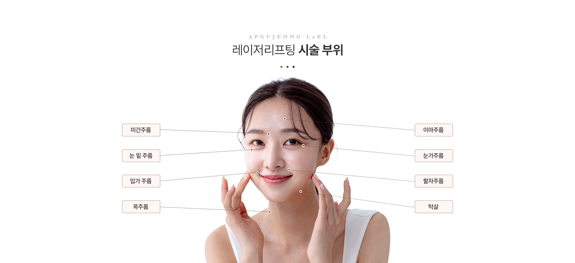 레이저리프팅 시술부위