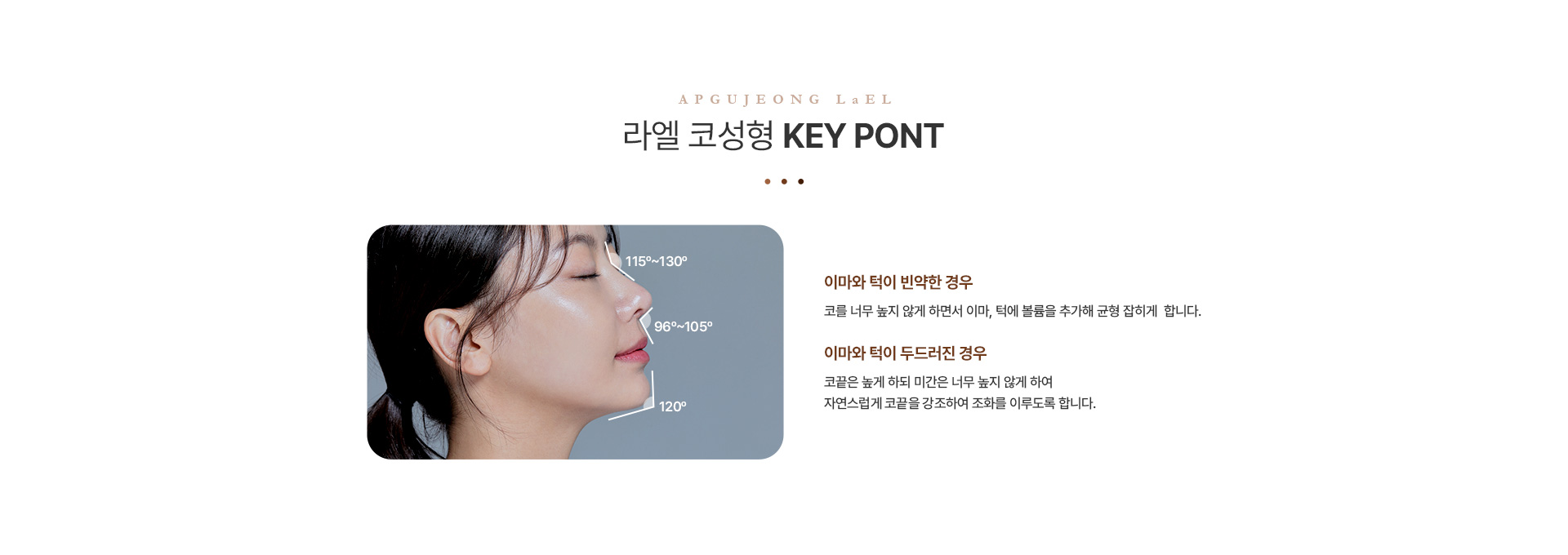 코성형 키포인트