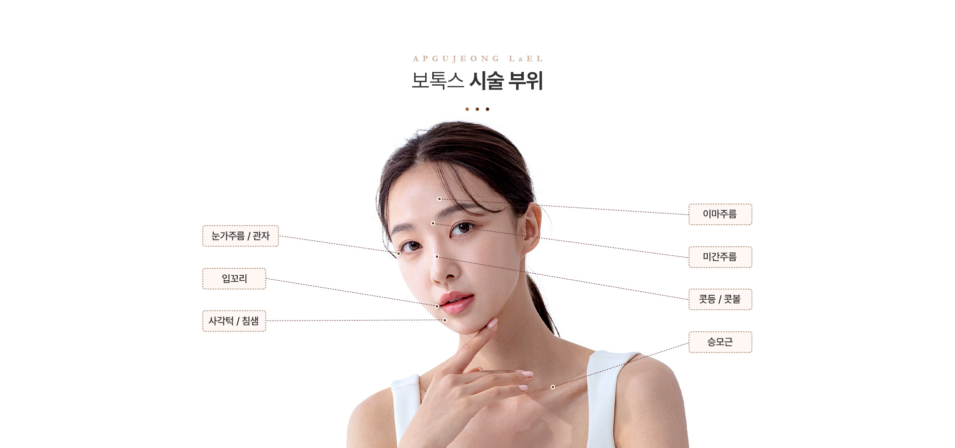 보톡스 시술부위