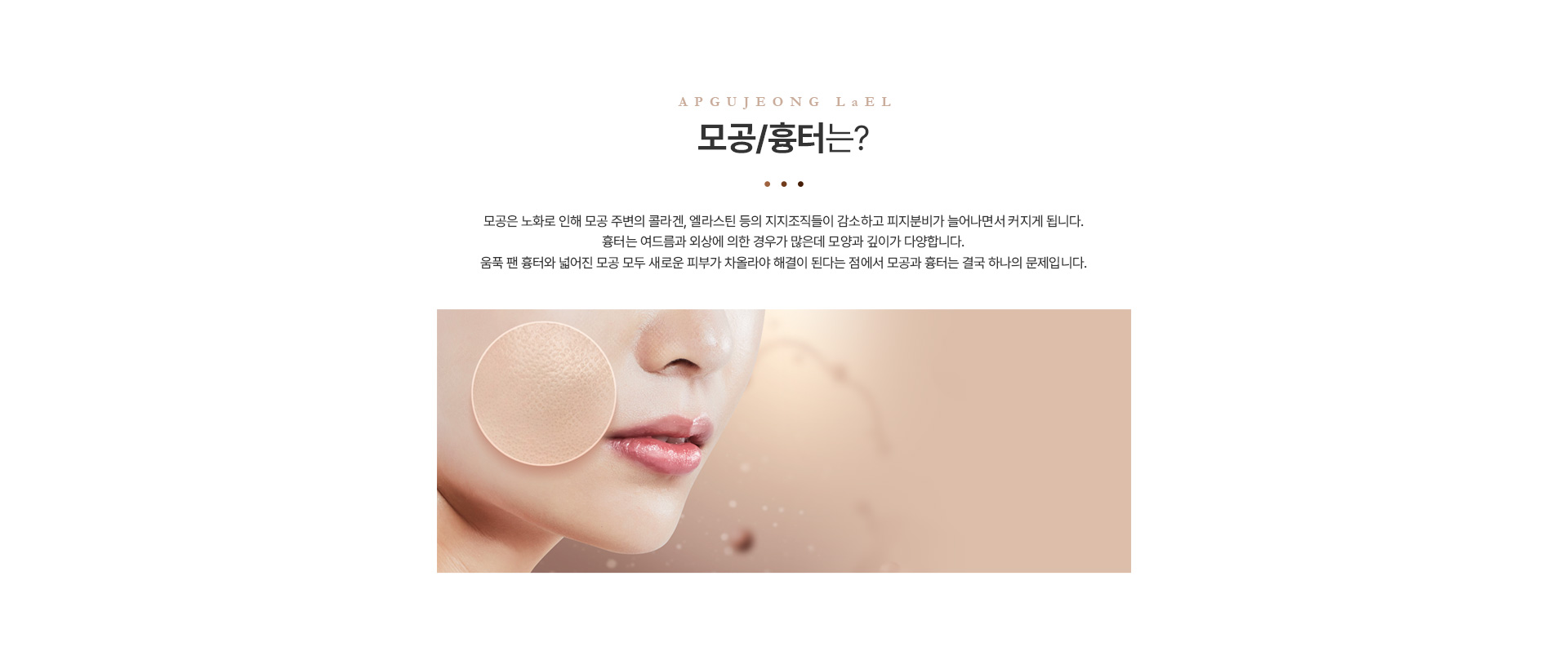 모공흉터 정의