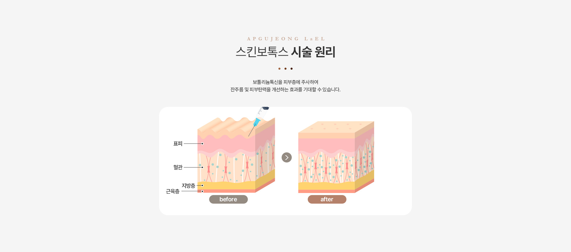 스킨보톡스 비교
